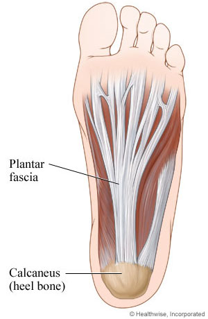 plantar fascia ligament heel pain